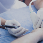 ELECTROLISIS PERCUTÁNEA